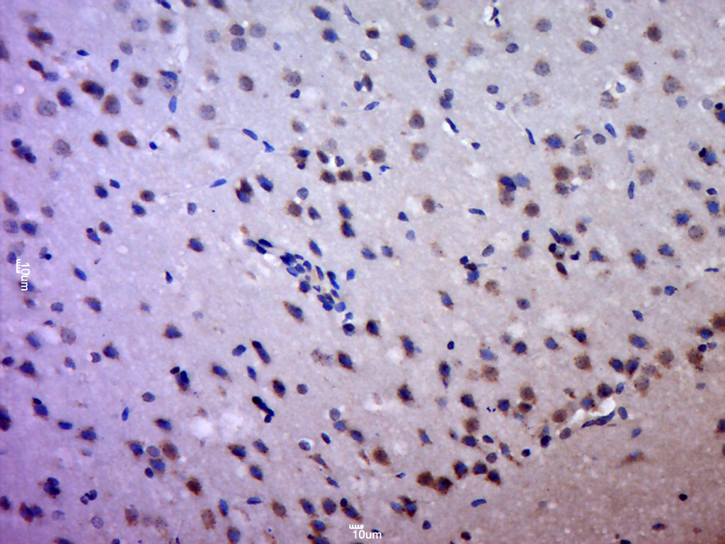 Paraformaldehyde-fixed, paraffin embedded rat brain tissue; Antigen retrieval by boiling in sodium citrate buffer (pH6.0) for 15min; Block endogenous peroxidase by 3% hydrogen peroxide for 20 minutes; Blocking buffer (normal goat serum) at 37°C for 30min; Antibody incubation with HCCS Polyclonal Antibody, Unconjugated (bs-15424R) at 1:400 overnight at 4°C, followed by a conjugated secondary antibody for 20 minutes and DAB staining.