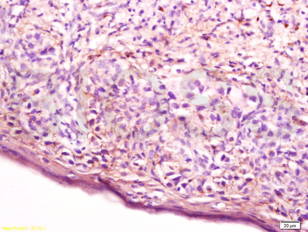 Formalin-fixed and paraffin embedded human skin of vulva tissue labeled with Anti-Cathepsin D Polyclonal Antibody, Unconjugated (bs-1615R) at 1:200 followed by conjugation to the secondary antibody, (SP-0023), and DAB staining