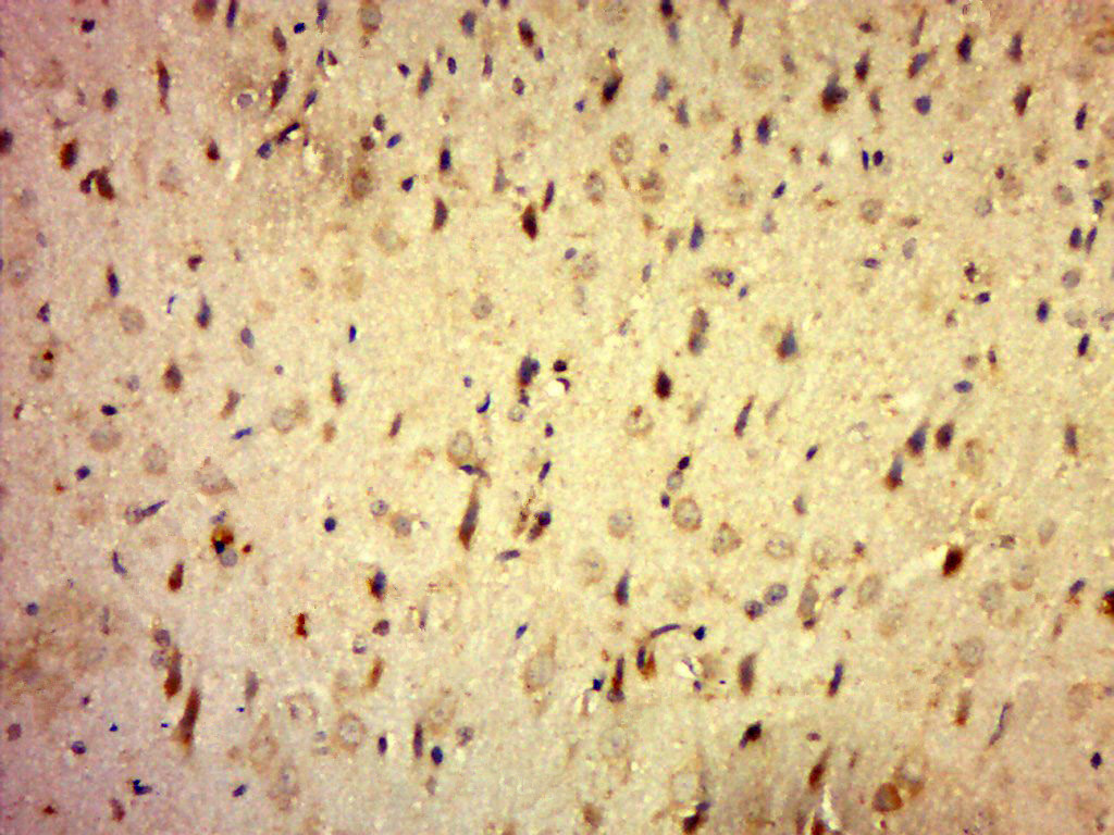 Paraformaldehyde-fixed, paraffin embedded rat brain; Antigen retrieval by boiling in sodium citrate buffer (pH6.0) for 15min; Block endogenous peroxidase by 3% hydrogen peroxide for 20 minutes; Blocking buffer (normal goat serum) at 37°C for 30min; Antibody incubation with C20orf196 Polyclonal Antibody, Unconjugated (bs-9699R) at 1:500 overnight at 4°C, followed by a conjugated secondary for 20 minutes and DAB staining.