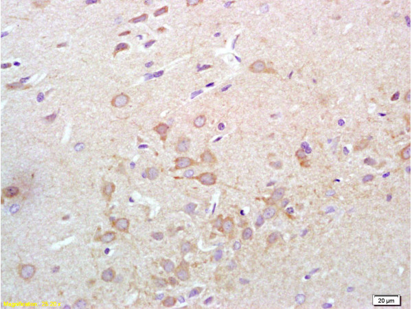 Formalin-fixed and paraffin embedded rat brain tissue labeled with Anti-Synaptotagmin 1/SYT1 Polyclonal Antibody, Unconjugated (bs-4172R) at 1:200 followed by conjugation to the secondary antibody, (SP-0023), and DAB staining
