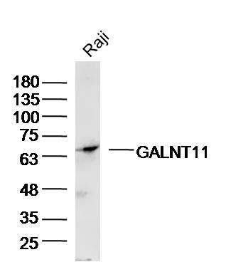 Raji Cell lysates probed with GALNT11/GalNAc-T11 Polyclonal Antibody, unconjugated (bs-13271R) at 1:300 overnight at 4°C followed by a conjugated secondary antibody for 60 minutes at 37°C.