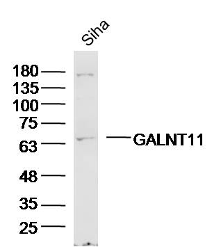 Siha Cell lysates probed with GALNT11/GalNAc-T11 Polyclonal Antibody, unconjugated (bs-13271R) at 1:300 overnight at 4°C followed by a conjugated secondary antibody for 60 minutes at 37°C.