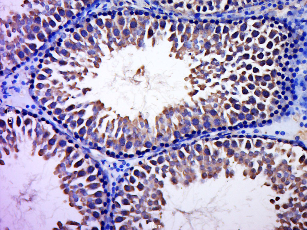 Paraformaldehyde-fixed, paraffin embedded rat testis; Antigen retrieval by boiling in sodium citrate buffer (pH6.0) for 15min; Block endogenous peroxidase by 3% hydrogen peroxide for 20 minutes; Blocking buffer (normal goat serum) at 37°C for 30min; Antibody incubation with CCDC93 Polyclonal Antibody, Unconjugated (bs-8143R) at 1:400 overnight at 4°C, followed by a conjugated secondary for 20 minutes and DAB staining.