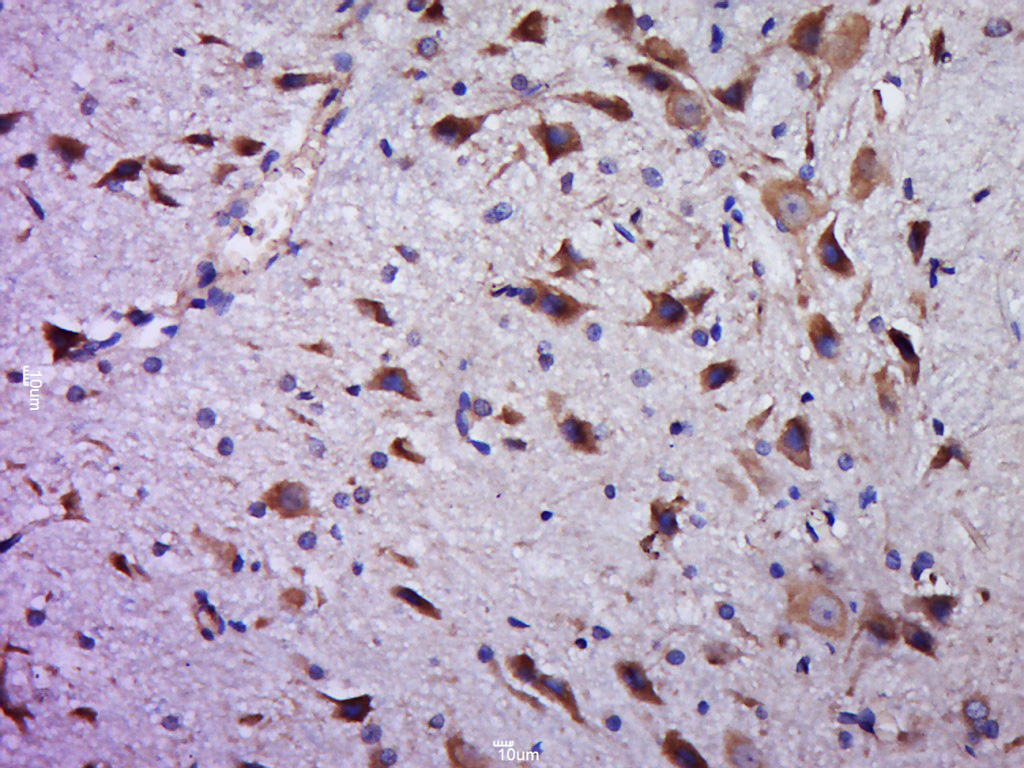 Paraformaldehyde-fixed, paraffin embedded rat brain; Antigen retrieval by boiling in sodium citrate buffer (pH6.0) for 15min; Block endogenous peroxidase by 3% hydrogen peroxide for 20 minutes; Blocking buffer (normal goat serum) at 37°C for 30min; Antibody incubation with C20orf94 Polyclonal Antibody, Unconjugated (bs-15119R) at 1:400 overnight at 4°C, followed by a conjugated secondary for 20 minutes and DAB staining. Paraformaldehyde-fixed, paraffin embedded rat brain; Antigen retrieval by boiling in sodium citrate buffer (pH6.0) for 15min; Block endogenous peroxidase by 3% hydrogen peroxide for 20 minutes; Blocking buffer (normal goat serum) at 37°C for 30min; Antibody incubation with C20orf94 Polyclonal Antibody, Unconjugated (bs-15119R) at 1:400 overnight at 4°C, followed by a conjugated secondary for 20 minutes and DAB staining.