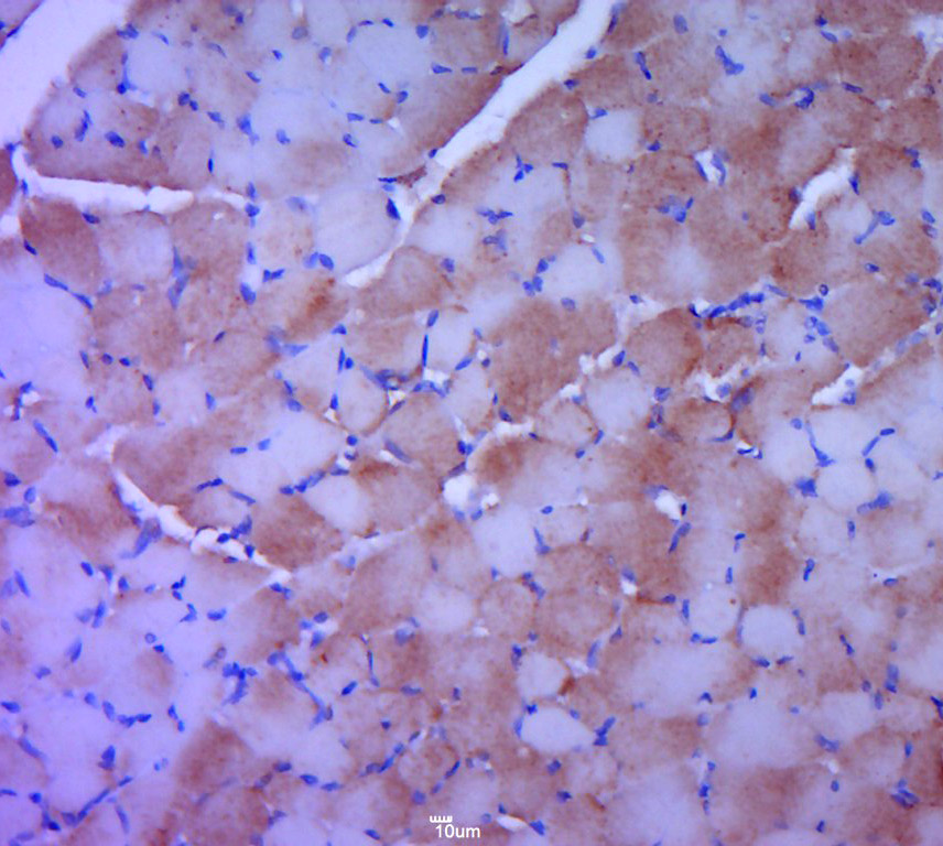 Paraformaldehyde-fixed, paraffin embedded rat skeletal muscle; Antigen retrieval by boiling in sodium citrate buffer (pH6.0) for 15min; Block endogenous peroxidase by 3% hydrogen peroxide for 20 minutes; Blocking buffer (normal goat serum) at 37°C for 30min; Antibody incubation with Creatine Kinase MM Polyclonal Antibody, Unconjugated (bs-7530R) at 1:400 overnight at 4°C, followed by a conjugated secondary for 20 minutes and DAB staining.