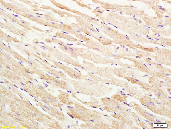 Formalin-fixed and paraffin embedded rat heart tissue labeled with Anti-phospho-ASK1(Thr845) Polyclonal Antibody, Unconjugated (bs-3031R) at 1:200 followed by conjugation to the secondary antibody, (SP-0023), and DAB staining