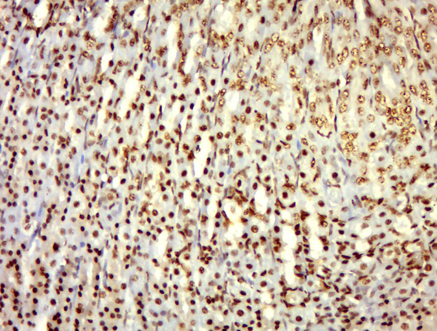 Paraformaldehyde-fixed, paraffin embedded rat stomach; Antigen retrieval by boiling in sodium citrate buffer (pH6.0) for 15min; Block endogenous peroxidase by 3% hydrogen peroxide for 20 minutes; Blocking buffer (normal goat serum) at 37°C for 30min; Antibody incubation with alpha Adducin(Ser436) Polyclonal Antibody, Unconjugated (bs-15968R) at 1:400 overnight at 4°C, followed by a conjugated secondary for 20 minutes and DAB staining.