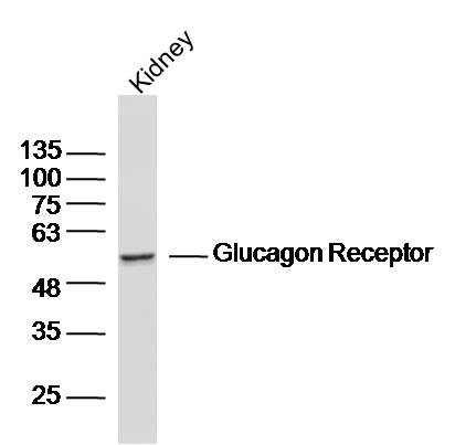 Mouse kidney lysates probed with Glucagon Receptor Polyclonal Antibody, unconjugated (bs-3945R) at 1:300 overnight at 4°C followed by a conjugated secondary antibody for 60 minutes at 37°C.
