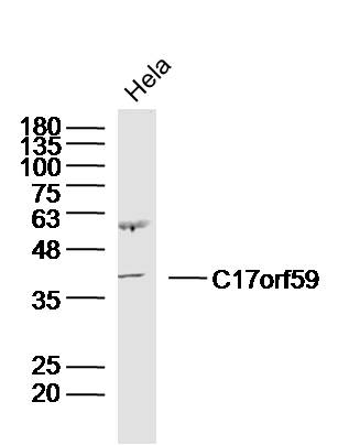 HeLa Cell lysates probed with C17orf59 Polyclonal Antibody, unconjugated (bs-9838R) at 1:300 overnight at 4°C followed by a conjugated secondary antibody for 60 minutes at 37°C. HeLa Cell lysates probed with C17orf59 Polyclonal Antibody, unconjugated (bs-9838R) at 1:300 overnight at 4°C followed by a conjugated secondary antibody for 60 minutes at 37°C.