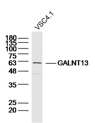 VSC4.1 Cell lysates probed with GALNT13/GalNAc-T13 Polyclonal Antibody, unconjugated (bs-13274R) at 1:300 overnight at 4°C followed by a conjugated secondary antibody for 60 minutes at 37°C.