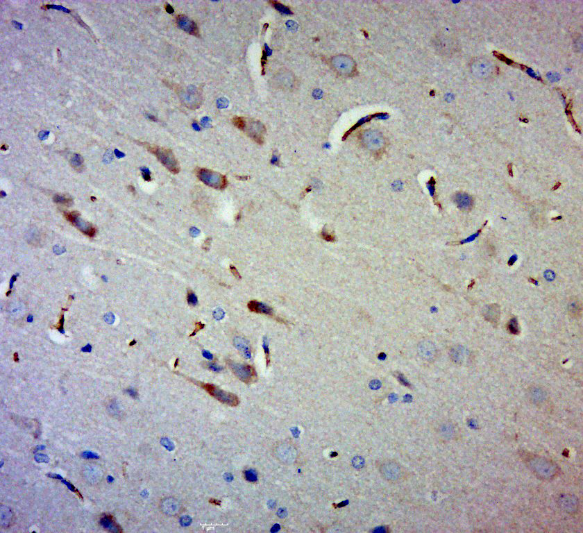 Paraformaldehyde-fixed, paraffin embedded rat brain; Antigen retrieval by boiling in sodium citrate buffer (pH6.0) for 15min; Block endogenous peroxidase by 3% hydrogen peroxide for 20 minutes; Blocking buffer (normal goat serum) at 37°C for 30min; Antibody incubation with Gigaxonin Polyclonal Antibody, Unconjugated (bs-11025R) at 1:400 overnight at 4°C, followed by a conjugated secondary for 20 minutes and DAB staining.