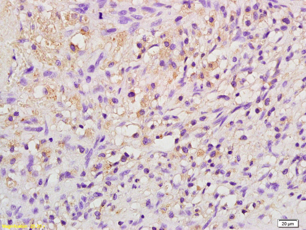Formalin-fixed and paraffin embedded rat kidney labeled with Anti-EPO Polyclonal Antibody, Unconjugated (bs-2343R) at 1:200 followed by conjugation to the secondary antibody and DAB staining Formalin-fixed and paraffin embedded rat kidney labeled with Anti-EPO Polyclonal Antibody, Unconjugated (bs-2343R) at 1:200 followed by conjugation to the secondary antibody and DAB staining