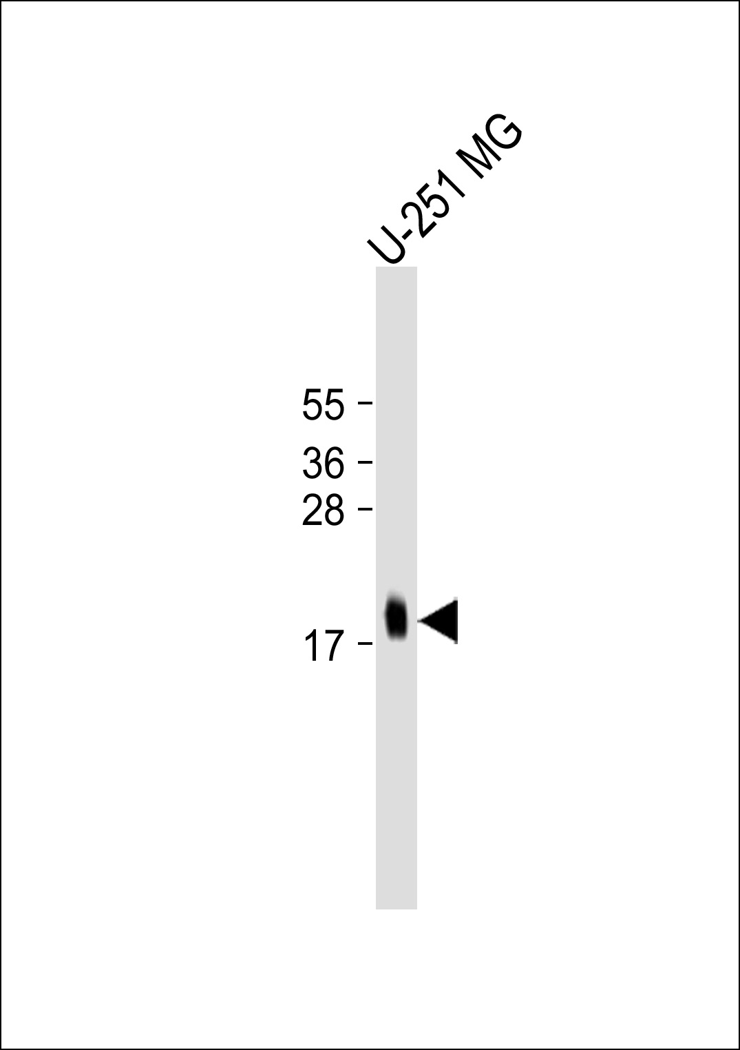 U251MG cell lysate (20ug) probed with bsm-51038M MCFD2 (165CT13.1.6) Monoclonal Antibody at 1:1000 dilution and 4℃ overnight incubation, followed by secondary antibody incubation for 60min at room temperature. U251MG cell lysate (20ug) probed with bsm-51038M MCFD2 (165CT13.1.6) Monoclonal Antibody at 1:1000 dilution and 4℃ overnight incubation, followed by secondary antibody incubation for 60min at room temperature.