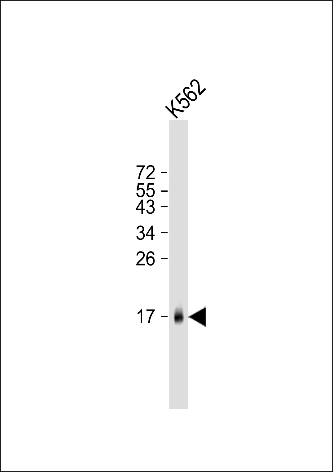 K562 cell lysate (20ug) probed with bsm-51038M MCFD2 (165CT13.1.6) Monoclonal Antibody at 1:1000 dilution and 4℃ overnight incubation, followed by secondary antibody incubation for 60min at room temperature. K562 cell lysate (20ug) probed with bsm-51038M MCFD2 (165CT13.1.6) Monoclonal Antibody at 1:1000 dilution and 4℃ overnight incubation, followed by secondary antibody incubation for 60min at room temperature.