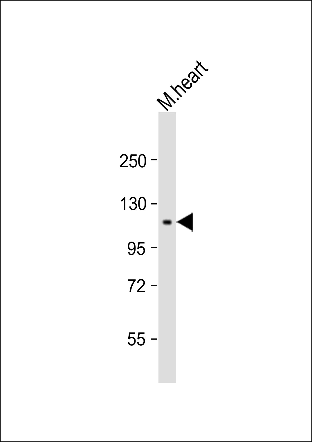 Mouse heart lysates probed with RET (188CT11.2.3) Monoclonal Antibody, unconjugated (bsm-51046M) at 1:1000 overnight at 4°C followed by a conjugated secondary antibody for 60 minutes at 37°C.