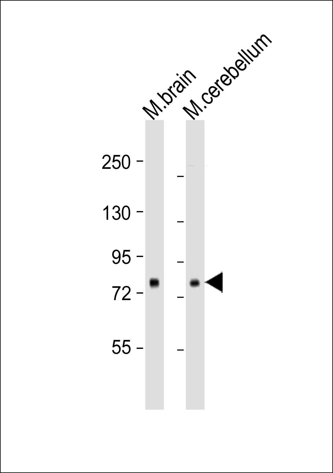 Lane 1: Mouse brain lysates; Lane 2: mouse cerebellum lysates; probed with RPS6KA1 (205CT18.3.1) Monoclonal Antibody, unconjugated (bsm-51052M) at 1:1000 overnight at 4°C followed by a conjugated secondary antibody for 60 minutes at 37°C.
