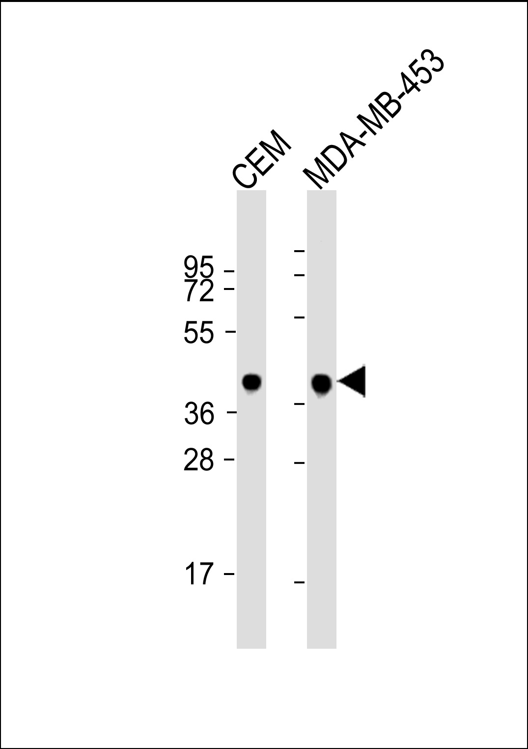 Lane 1: CEM lysates; Lane 2: MDA-MB-453 lysates; probed with MAPK3 (7C2) Monoclonal Antibody, unconjugated (bsm-51092M) at 1:1000 overnight at 4°C followed by a conjugated secondary antibody for 60 minutes at 37°C.