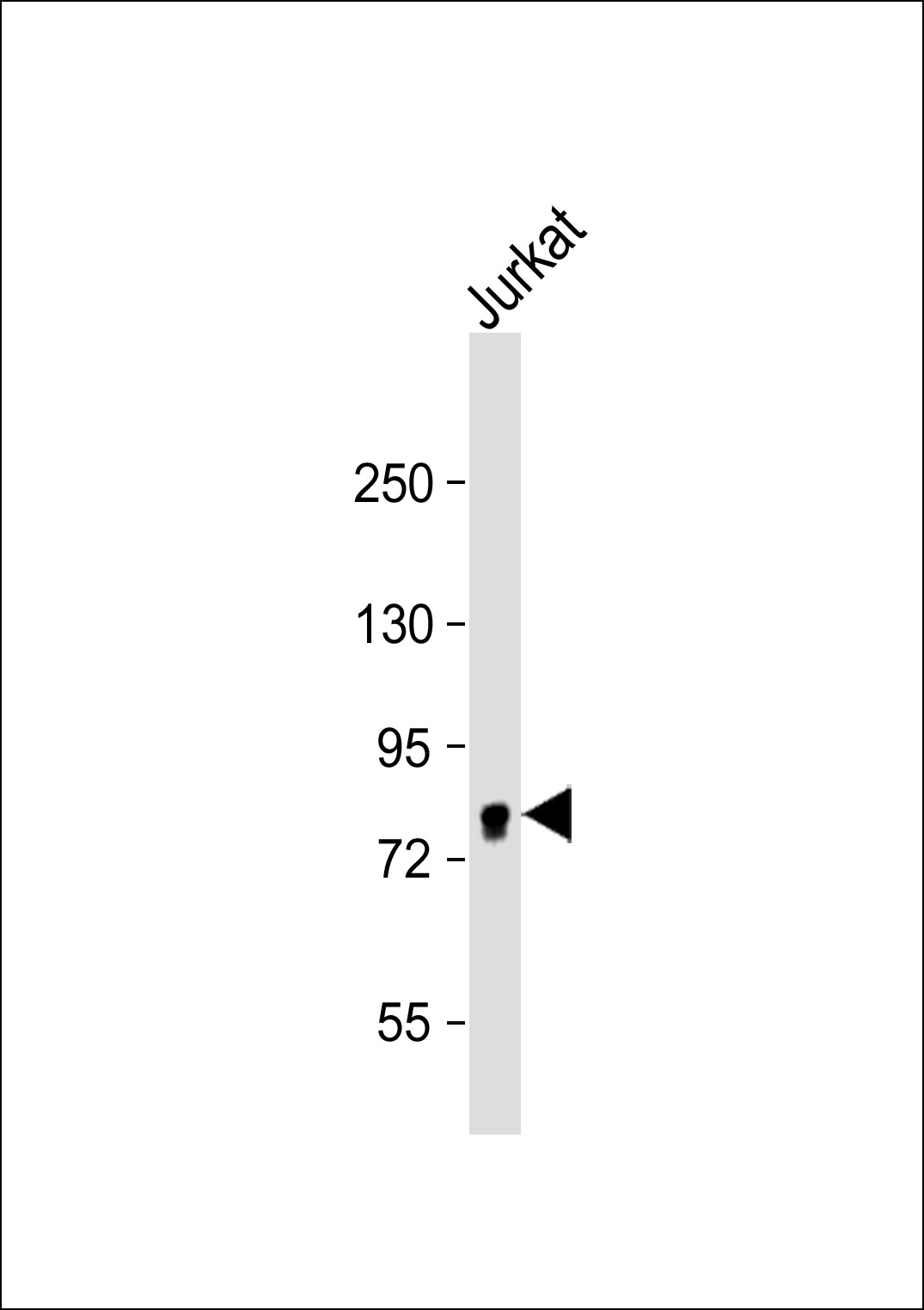 Jurkat cell lysate probed with bsm-51102M EIF4B (355CT12.6.5) Monoclonal Antibody at 1:1000 dilution and 4℃ overnight incubation, followed by secondary antibody incubation for 60min at room temperature.