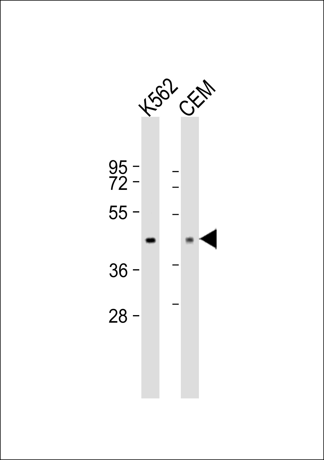 Lane 1: K562; Lane 2: CEM lysate at 20 µg per lane, probed with bsm-51104M ACTA1 (337CT30.10.1) Monoclonal Antibody at 1:1000 dilution and 4℃ overnight incubation, followed by secondary antibody incubation for 60min at room temperature.