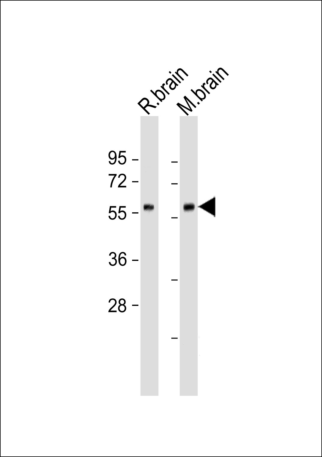 Lane 1: rat brain, Lane 2: mouse brain lysate probed with bsm-51143M GAD2 (458CT17.2.4) Monoclonal Antibody at 1:500 dilution and 4℃ overnight incubation, followed by secondary antibody incubation for 60min at room temperature.