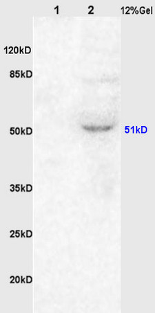 L1 rat kidney lysates, L2 rat brain lysates probed (bs-1150R) Anti-ChRM1/Acetylcholine receptor(M1) Polyclonal, Unconjugated at 1:200 in 4˚C. Followed by conjugation to secondary antibody (bs-0295G-HRP) at 1:3000 90min in 37˚C. Predicted band and observed band size: 51kD.