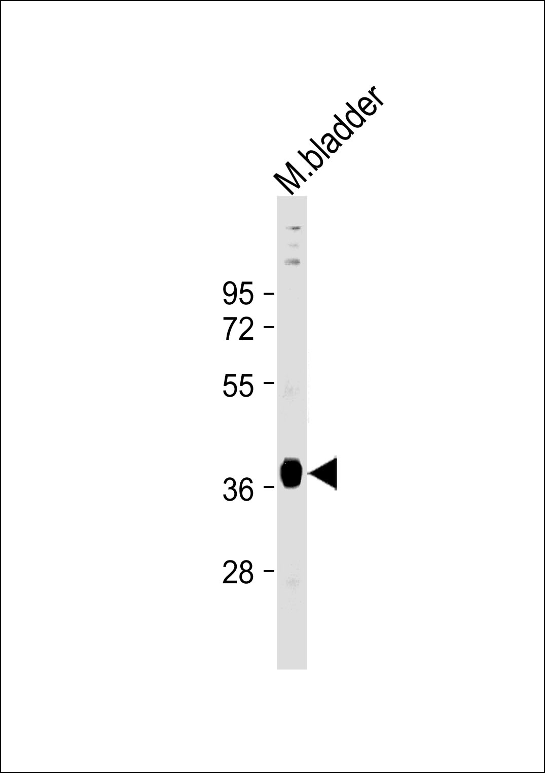 Mouse bladder lysates; probed with STRA8 (526CT11.1.5) Monoclonal Antibody, unconjugated (bsm-51172M) at 1:1000 overnight at 4°C followed by a conjugated secondary antibody for 60 minutes at 37°C.