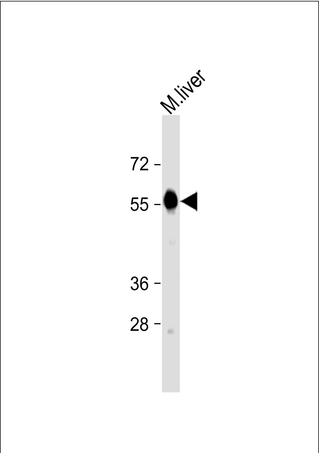 Mouse liver cell lysates; probed with CAT (626CT4.3.8) Monoclonal Antibody, unconjugated (bsm-51185M) at 1:1000 overnight at 4°C followed by a conjugated secondary antibody for 60 minutes at 37°C.