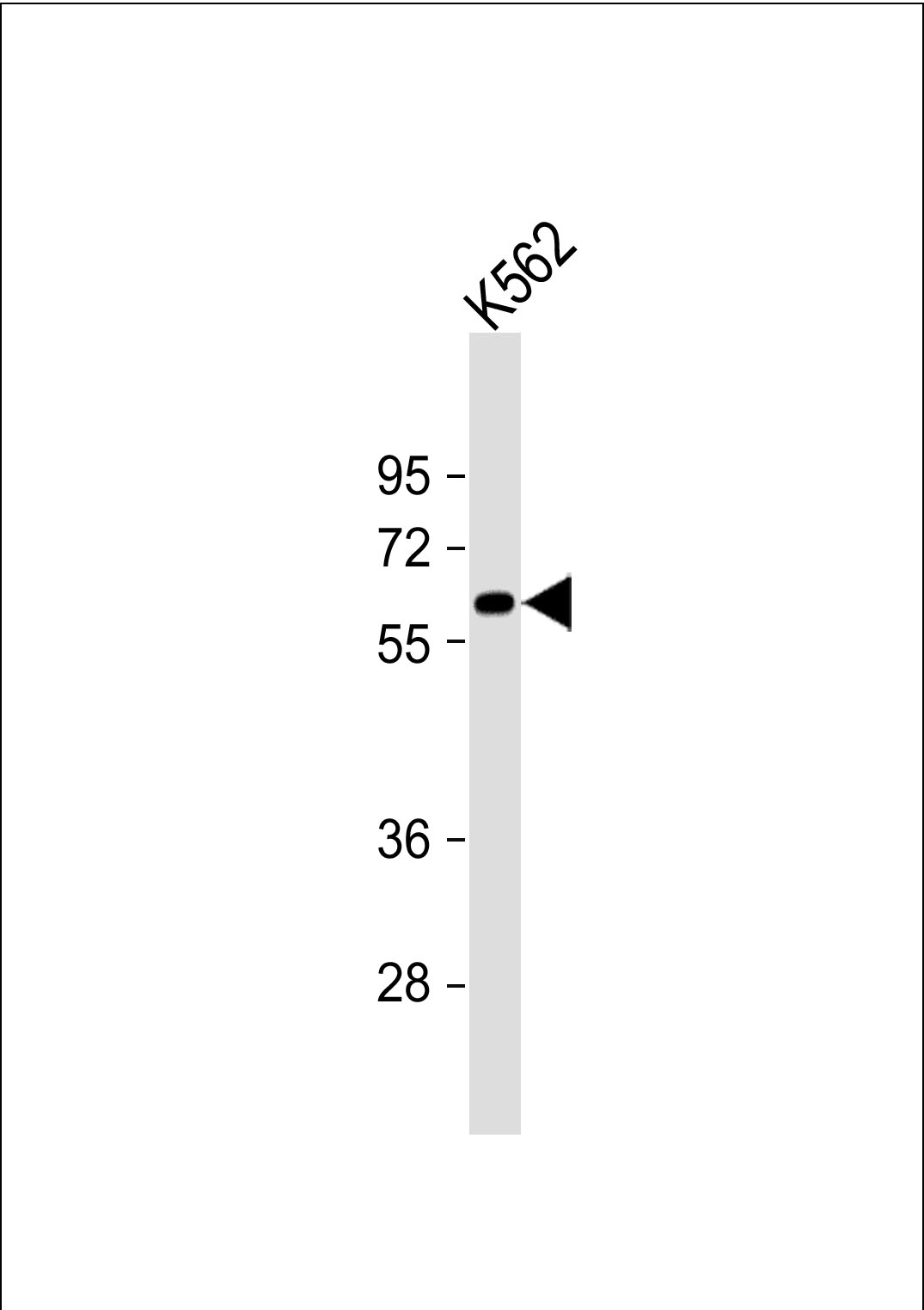 K562 cell lysates; probed with CAT (626CT4.3.8) Monoclonal Antibody, unconjugated (bsm-51185M) at 1:1000 overnight at 4°C followed by a conjugated secondary antibody for 60 minutes at 37°C.