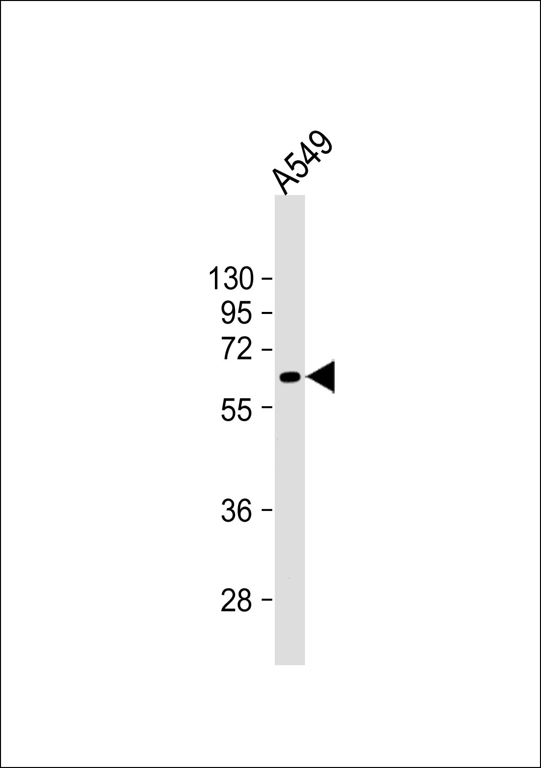 A549 cell lysates probed with PODXL (632CT5.11.4) Monoclonal Antibody, unconjugated (bsm-51201M) at 1:1000 overnight at 4°C followed by a conjugated secondary antibody for 60 minutes at 37°C.
