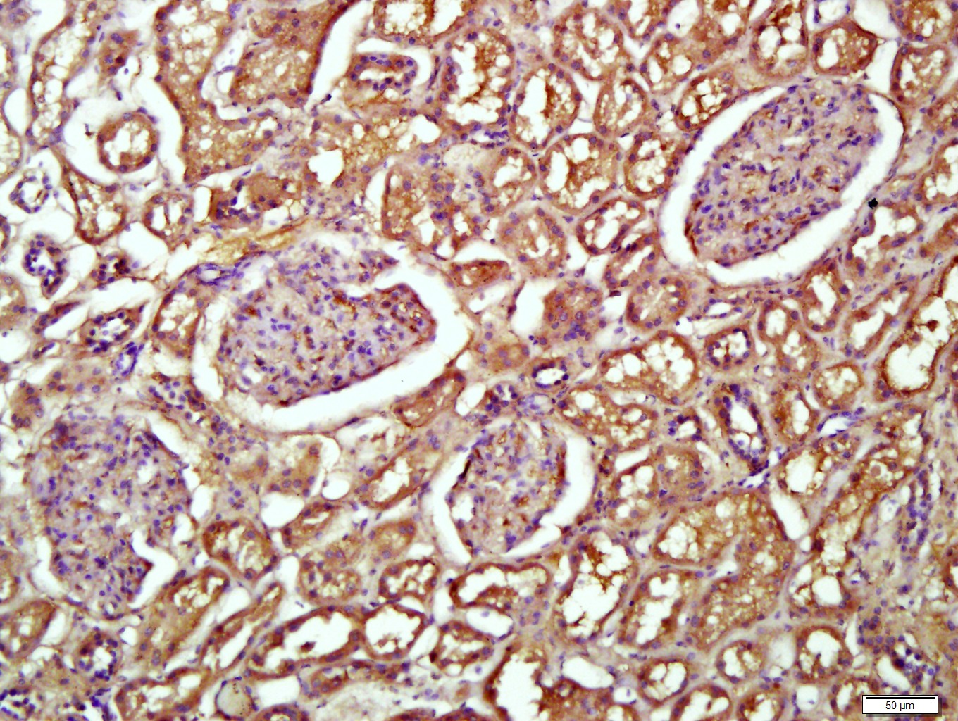 Paraformaldehyde-fixed, paraffin embedded Human kidney; Antigen retrieval by boiling in sodium citrate buffer (pH6.0) for 15min; Block endogenous peroxidase by 3% hydrogen peroxide for 20 minutes; Blocking buffer (normal goat serum) at 37°C for 30min; Antibody incubation with Transferrin(1F10) Monoclonal Antibody, Unconjugated (bsm-2052M) at 1:400 overnight at 4°C, followed by a conjugated secondary antibody for 20 minutes and DAB staining.
