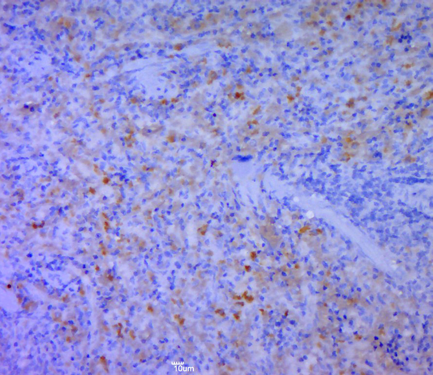 Paraformaldehyde-fixed, paraffin embedded rat spleen; Antigen retrieval by boiling in sodium citrate buffer (pH6.0) for 15min; Block endogenous peroxidase by 3% hydrogen peroxide for 20 minutes; Blocking buffer (normal goat serum) at 37°C for 30min; Antibody incubation with CD5L Polyclonal Antibody, Unconjugated (bs-2487R) at 1:400 overnight at 4°C, followed by a conjugated secondary for 20 minutes and DAB staining.