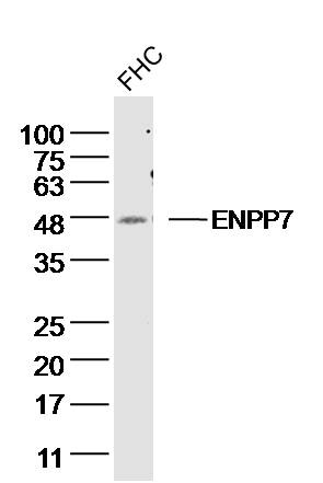 FHC Cell lysates probed with ENPP7 Polyclonal Antibody, unconjugated (bs-4277R) at 1:300 overnight at 4°C followed by a conjugated secondary antibody for 60 minutes at 37°C.