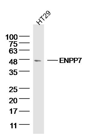 HT29 Cell lysates probed with ENPP7 Polyclonal Antibody, unconjugated (bs-4277R) at 1:300 overnight at 4°C followed by a conjugated secondary antibody for 60 minutes at 37°C.