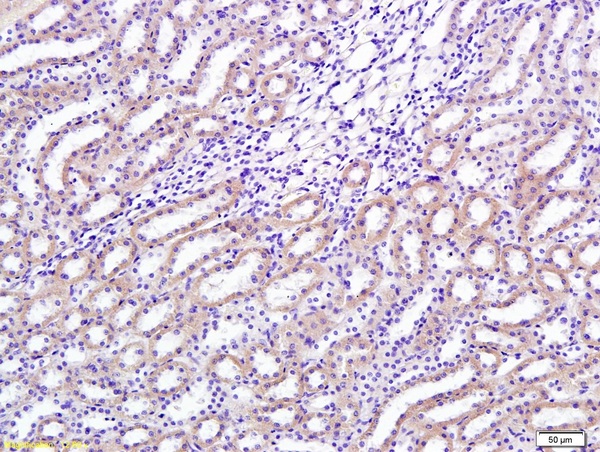 Formalin-fixed and paraffin embedded rat renal tissue labeled with Anti-TGF-beta-1 Polyclonal Antibody, Unconjugated(bs-0086R) 1:200 followed by conjugation to the secondary antibody and DAB staining