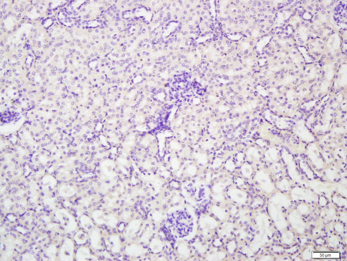 Paraformaldehyde-fixed, paraffin embedded Mouse kidney; Antigen retrieval by boiling in sodium citrate buffer (pH6.0) for 15min; Block endogenous peroxidase by 3% hydrogen peroxide for 20 minutes; Blocking buffer (normal goat serum) at 37°C for 30min; Antibody incubation with ENPP7 Polyclonal Antibody, Unconjugated (bs-4277R), followed by polypeptide blocking at 1:400 overnight at 4°C, followed by a conjugated secondary antibody for 20 minutes and DAB staining.