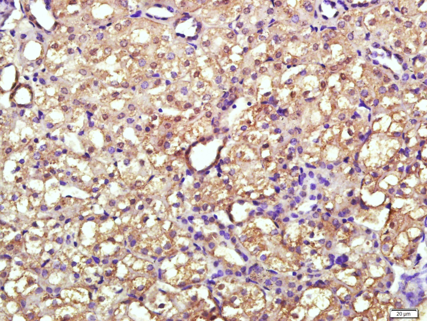 Paraformaldehyde-fixed, paraffin embedded Mouse kidney; Antigen retrieval by boiling in sodium citrate buffer (pH6.0) for 15min; Block endogenous peroxidase by 3% hydrogen peroxide for 20 minutes; Blocking buffer (normal goat serum) at 37°C for 30min; Antibody incubation with ENPP7 Polyclonal Antibody, Unconjugated (bs-4277R) at 1:400 overnight at 4°C, followed by a conjugated secondary antibody for 20 minutes and DAB staining.