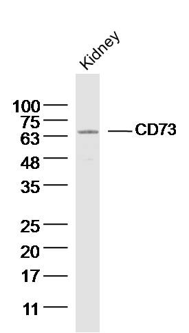 Mouse kidney lysates probed with CD73 Polyclonal Antibody, unconjugated (bs-4834R) at 1:300 overnight at 4°C followed by a conjugated secondary antibody for 60 minutes at 37°C.
