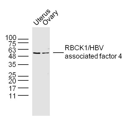 Lane 1: Mouse uterus lysate; Lane 2: mouse overy lysate probed with RBCK1 Polyclonal Antibody, unconjugated (bs-19761R) at 1:300 overnight at 4°C followed by a conjugated secondary antibody for 60 minutes at 37°C.