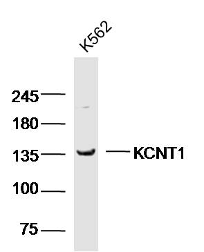 K562 cell lysates probed with KCNT1 Polyclonal Antibody, unconjugated (bs-20327R) at 1:300 overnight at 4°C followed by a conjugated secondary antibody for 60 minutes at 37°C.