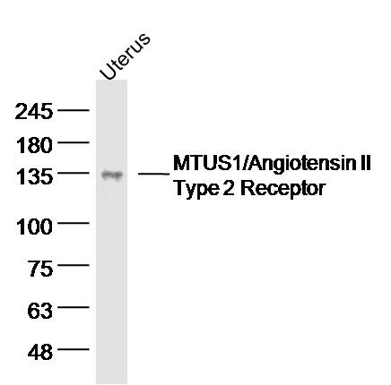 Mouse uterus lysates probed with MTUS1 Polyclonal Antibody, unconjugated (bs-6076R) at 1:300 overnight at 4°C followed by a conjugated secondary antibody for 60 minutes at 37°C.