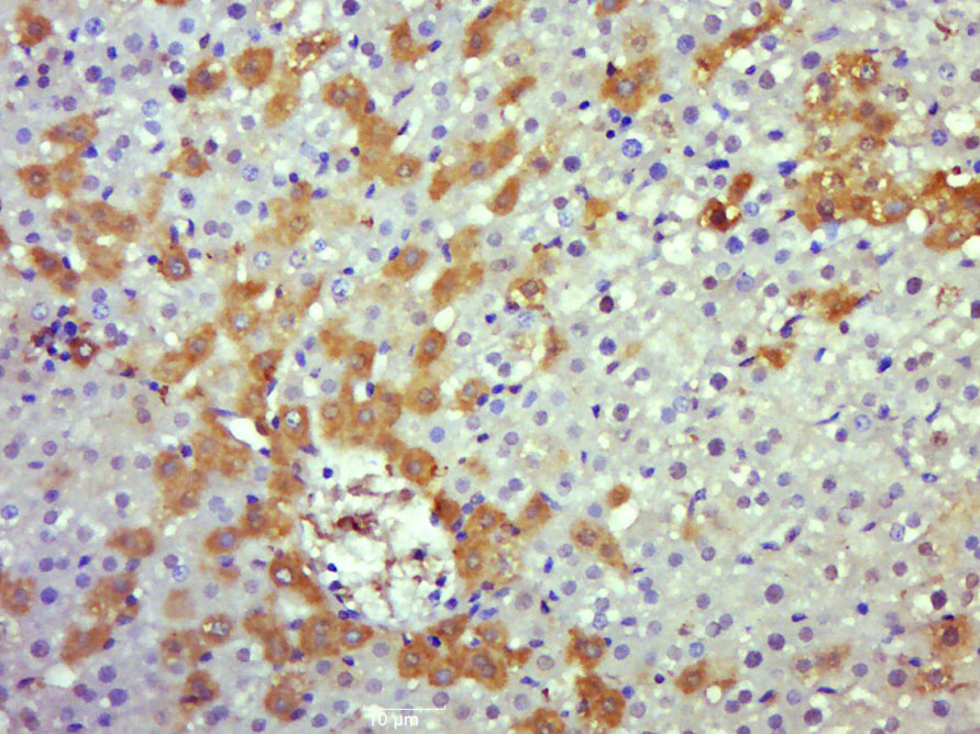 Paraformaldehyde-fixed, paraffin embedded rat liver; Antigen retrieval by boiling in sodium citrate buffer (pH6.0) for 15min; Block endogenous peroxidase by 3% hydrogen peroxide for 20 minutes; Blocking buffer (normal goat serum) at 37°C for 30min; Antibody incubation with caspase-8 subunit p18 Polyclonal Antibody, Unconjugated (bs-6463R) at 1:500 overnight at 4°C, followed by a conjugated secondary for 20 minutes and DAB staining.