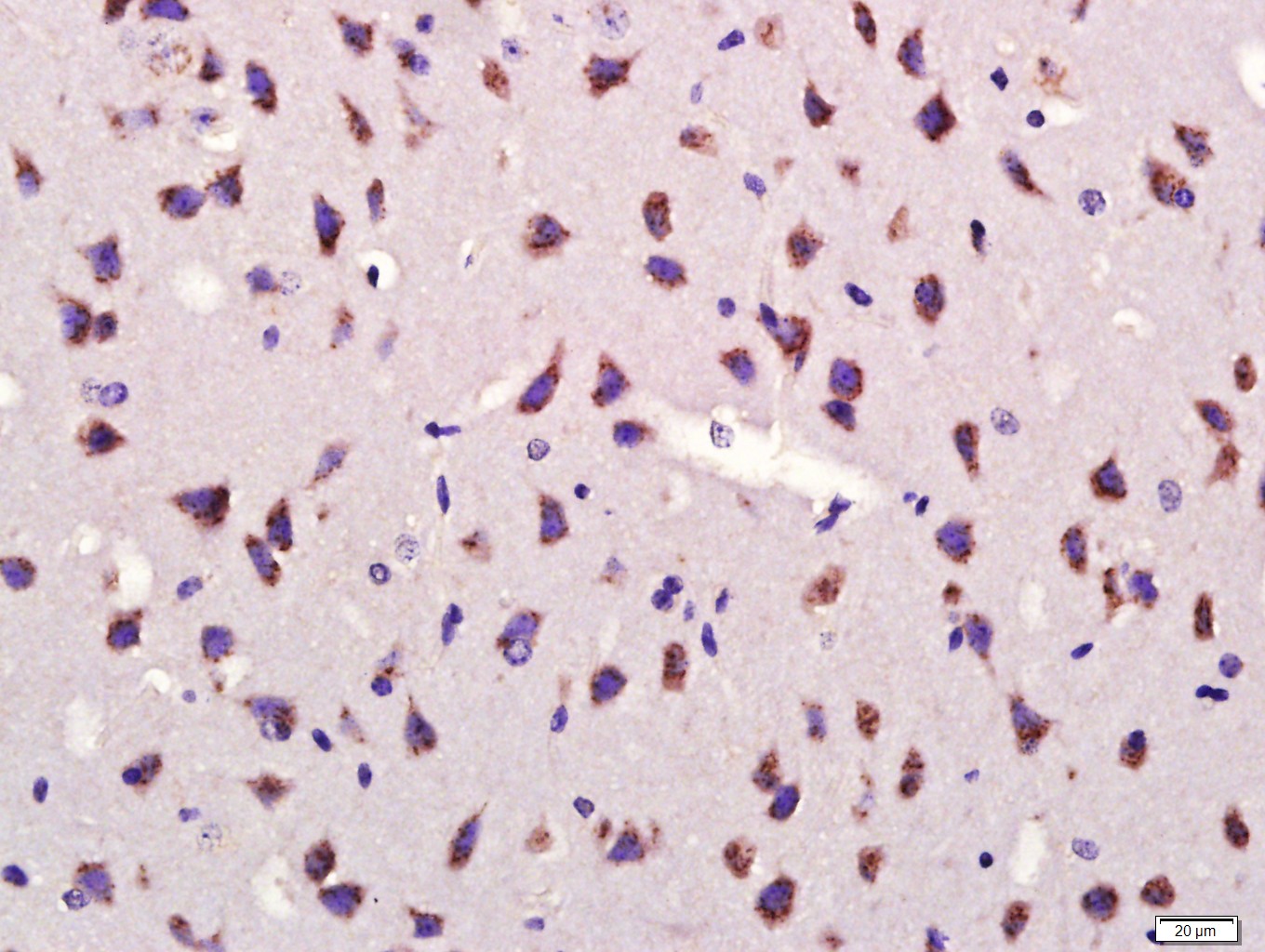 Paraformaldehyde-fixed, paraffin embedded mouse brain; Antigen retrieval by boiling in sodium citrate buffer (pH6.0) for 15min; Block endogenous peroxidase by 3% hydrogen peroxide for 20 minutes; Blocking buffer (normal goat serum) at 37°C for 30min; Antibody incubation with GDF10 Polyclonal Antibody, Unconjugated (bs-5720R) at 1:400 overnight at 4°C, followed by a conjugated secondary antibody for 20 minutes and DAB staining.