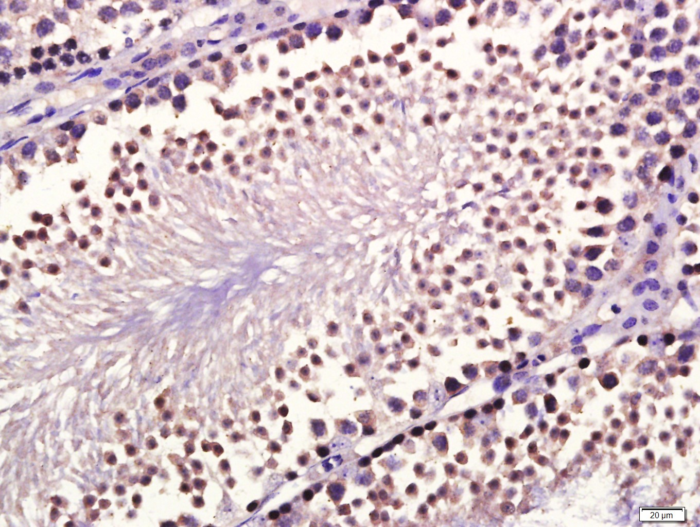 Paraformaldehyde-fixed, paraffin embedded mouse testis; Antigen retrieval by boiling in sodium citrate buffer (pH6.0) for 15min; Block endogenous peroxidase by 3% hydrogen peroxide for 20 minutes; Blocking buffer (normal goat serum) at 37°C for 30min; Antibody incubation with GDF10 Polyclonal Antibody, Unconjugated (bs-5720R) at 1:400 overnight at 4°C, followed by a conjugated secondary antibody for 20 minutes and DAB staining._x000D_ _x000D_
