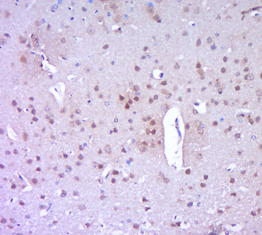 Paraformaldehyde-fixed, paraffin embedded mouse brain; Antigen retrieval by boiling in sodium citrate buffer (pH6.0) for 15min; Block endogenous peroxidase by 3% hydrogen peroxide for 20 minutes; Blocking buffer (normal goat serum) at 37°C for 30min; Antibody incubation with PARP1 Polyclonal Antibody, Unconjugated (bs-2138R) at 1:400 overnight at 4°C, followed by a conjugated secondary for 20 minutes and DAB staining.