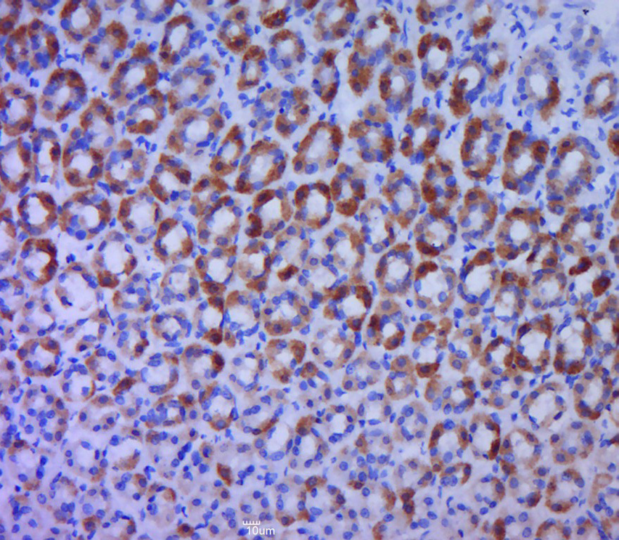 Paraformaldehyde-fixed, paraffin embedded rat stomach; Antigen retrieval by boiling in sodium citrate buffer (pH6.0) for 15min; Block endogenous peroxidase by 3% hydrogen peroxide for 20 minutes; Blocking buffer (normal goat serum) at 37°C for 30min; Antibody incubation with BTG1 Polyclonal Antibody, Unconjugated (bs-7526R) at 1:400 overnight at 4°C, followed by a conjugated secondary for 20 minutes and DAB staining.