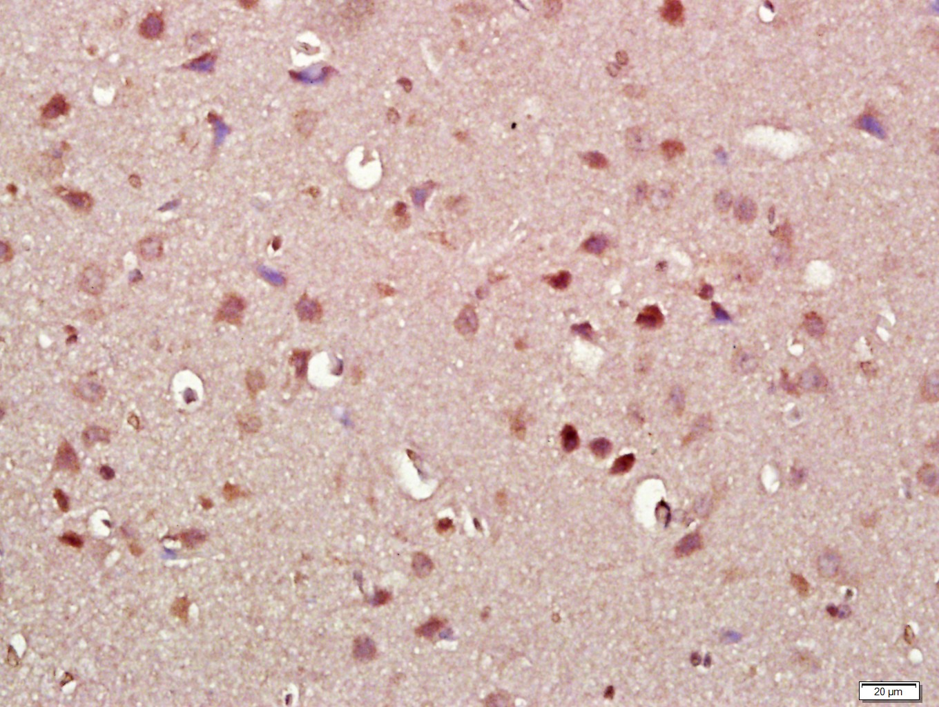 Paraformaldehyde-fixed, paraffin embedded rat brain; Antigen retrieval by boiling in sodium citrate buffer (pH6.0) for 15min; Block endogenous peroxidase by 3% hydrogen peroxide for 20 minutes; Blocking buffer (normal goat serum) at 37°C for 30min; Antibody incubation with alpha-Synuclein Polyclonal Antibody, Unconjugated (bs-0009R) at 1:500 overnight at 4°C, followed by a conjugated secondary  for 20 minutes and DAB staining.