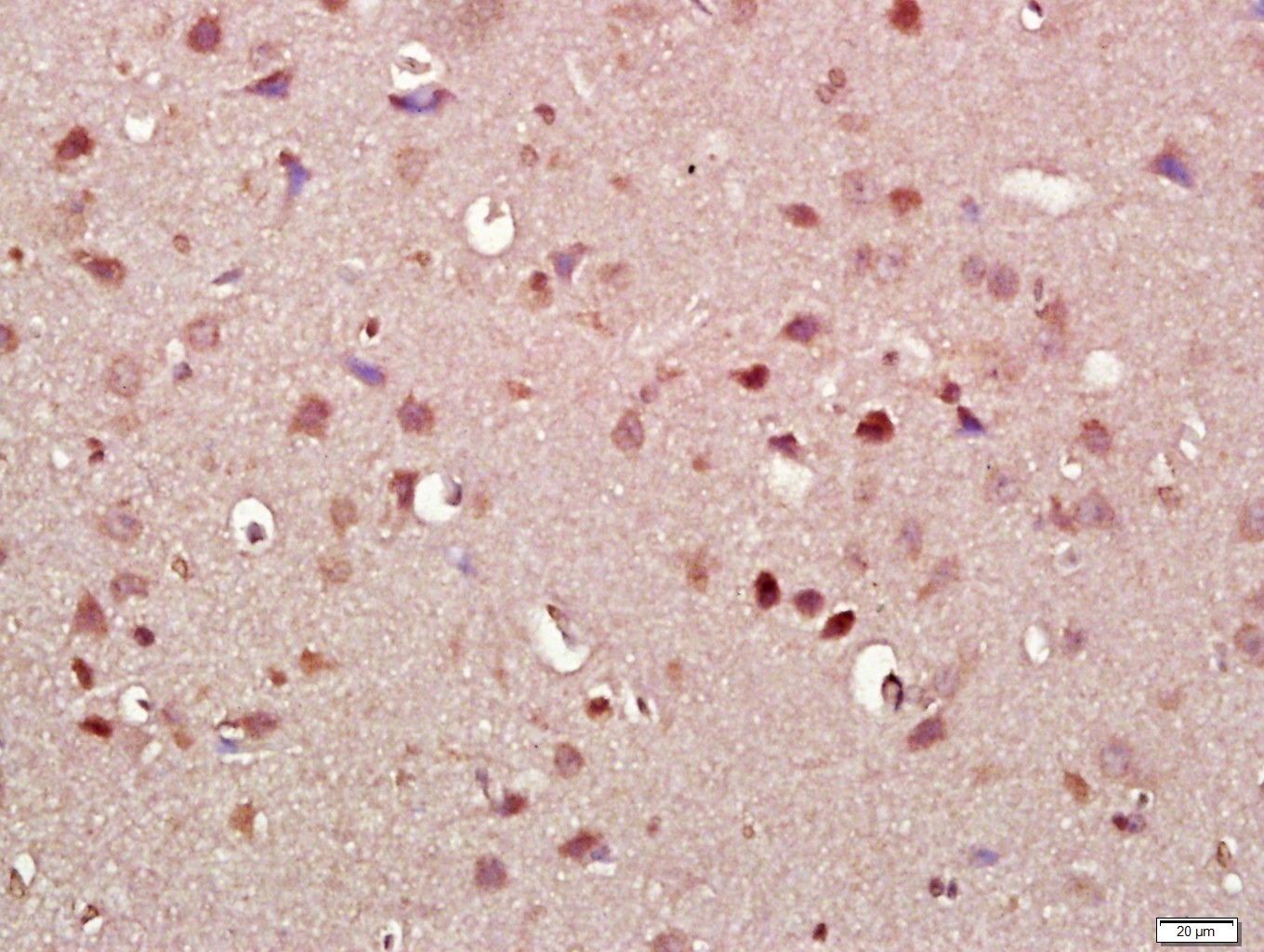Paraformaldehyde-fixed, paraffin embedded rat brain; Antigen retrieval by boiling in sodium citrate buffer (pH6.0) for 15min; Block endogenous peroxidase by 3% hydrogen peroxide for 20 minutes; Blocking buffer (normal goat serum) at 37°C for 30min; Antibody incubation with alpha-Synuclein Polyclonal Antibody, Unconjugated (bs-0009R) at 1:500 overnight at 4°C, followed by a conjugated secondary for 20 minutes and DAB staining.