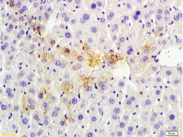 Formalin-fixed and paraffin embedded rat liver tissue labeled with Anti-Tsg101 Polyclonal Antibody (bs-1365R), Unconjugated at 1:200 followed by conjugation to the secondary antibody, (SP-0023), and DAB staining
