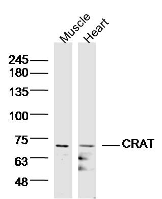 Lane 1: Mouse muscle lysates; Lane 2: mouse heart lysates probed with CRAT/CAT1 Polyclonal Antibody, Unconjugated (bs-15397R) at 1:300 overnight at 4˚C. Followed by a conjugated secondary antibody at 1:5000 for 90 min at 37˚C.