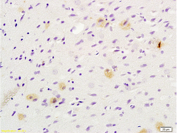 Formalin-fixed and paraffin embedded rat brain tissue labeled with Anti-Tsg101 Polyclonal Antibody (bs-1365R), Unconjugated at 1:200 followed by conjugation to the secondary antibody, (SP-0023), and DAB staining